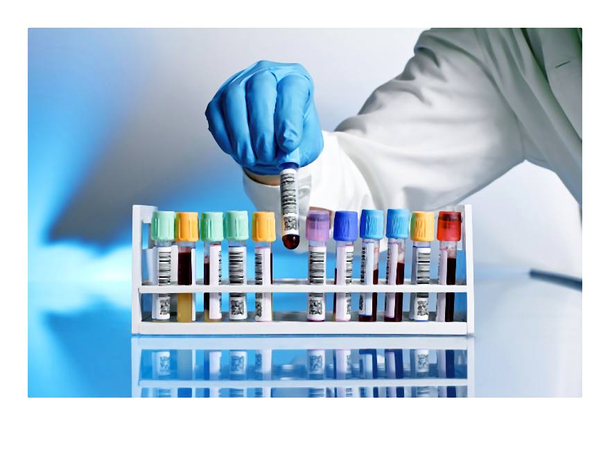 probowki_istock-002-2014-04-15 _ 23_56_33-75