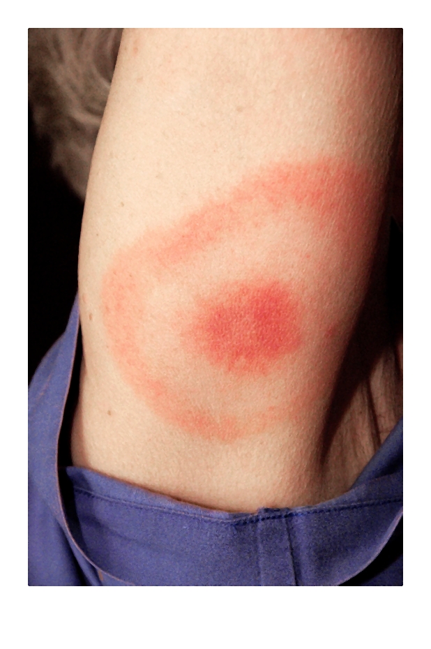 rumien_wedrujacy_foter_com-002-2014-06-08 _ 09_51_16-72