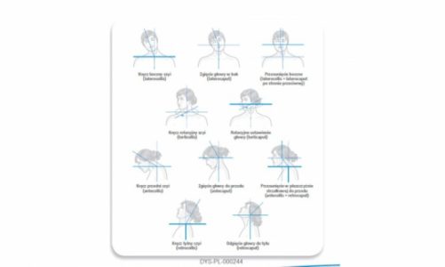 Dystonia – kiedy mimowolne ruchy ciała mogą zwiastować chorobę?