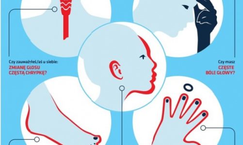 Akromegalia ? choroba widoczna gołym okiem, często jednak niedostrzegana!