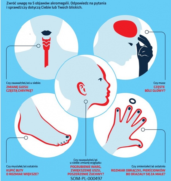 Akromegalia ? choroba widoczna gołym okiem, często jednak niedostrzegana!